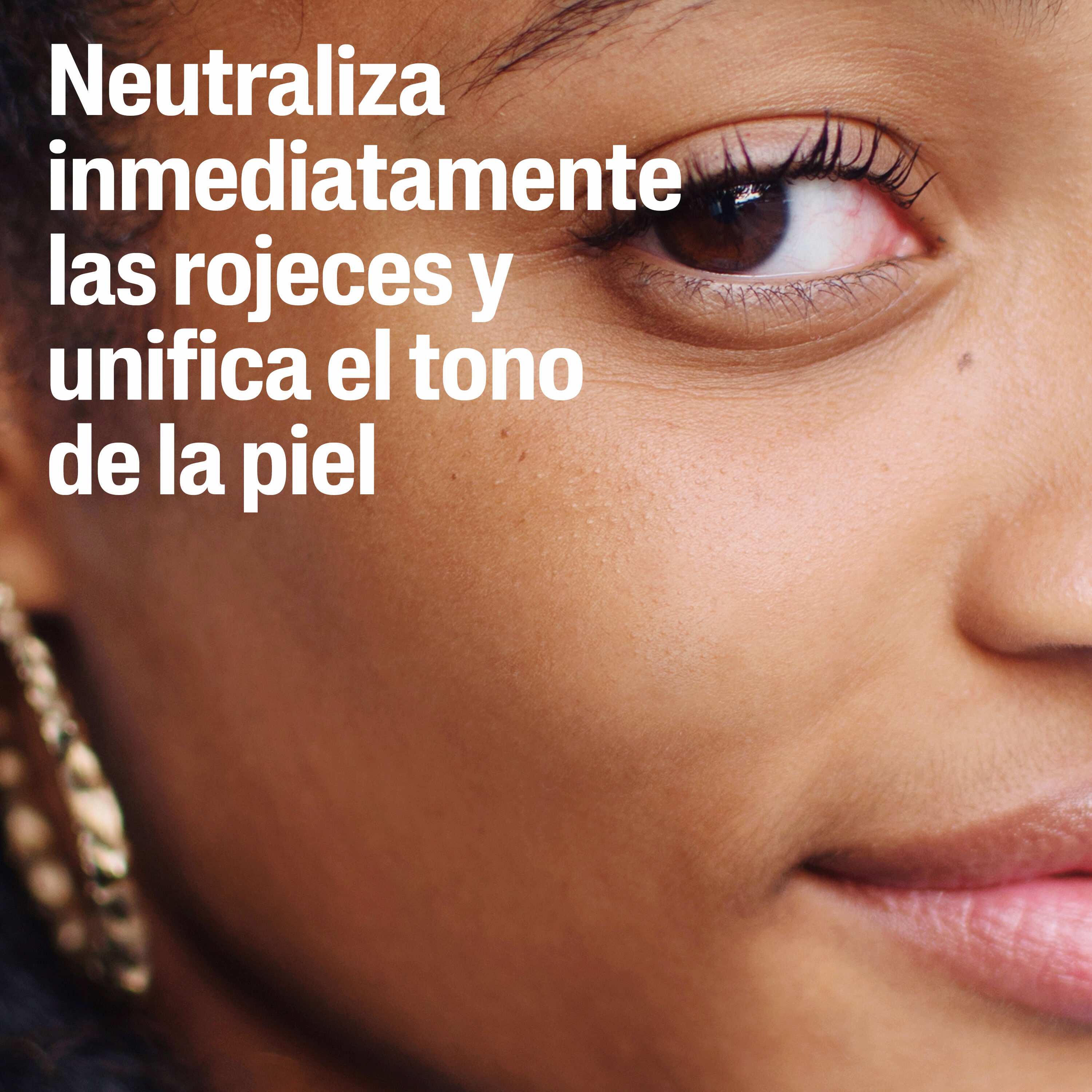 Cetaphil PRO Redness Control Hidratante SPF 30